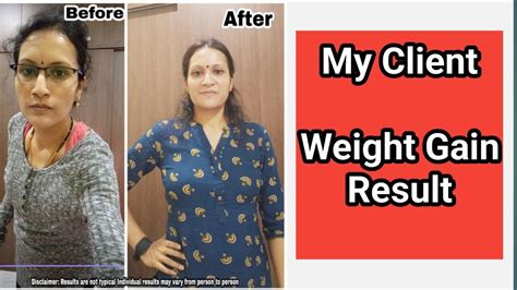 rexult|rexulti and weight gain.